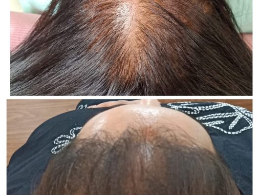 WhatsApp Image 2026-02-18 at 12.45.36 PM