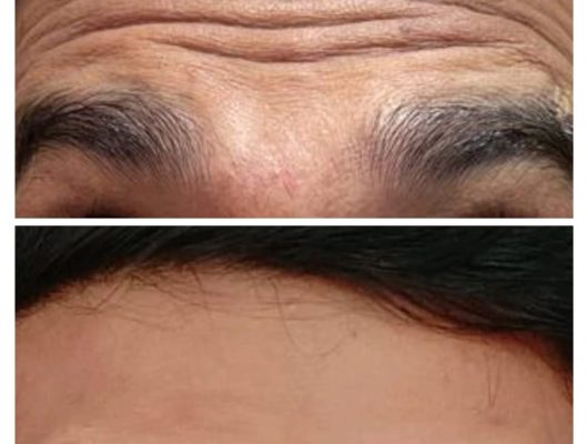 WhatsApp Image 2026-02-18 at 12.45.37 PM