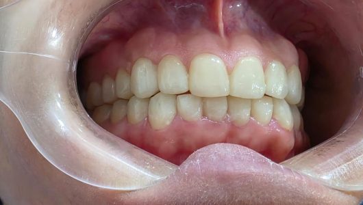 WhatsApp Image 2026-02-18 at 12.45.42 PM (1)